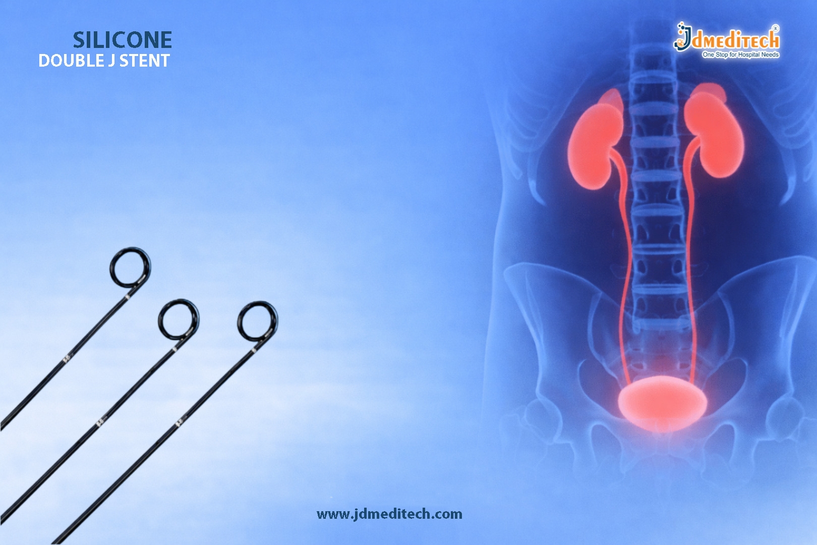 Silicone Double J Stent for Ureteral Drainage