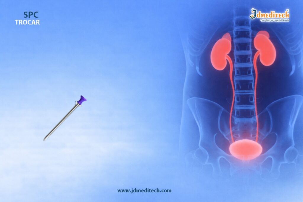 SPC Trocar: Safe Tool for Suprapubic Catheterization