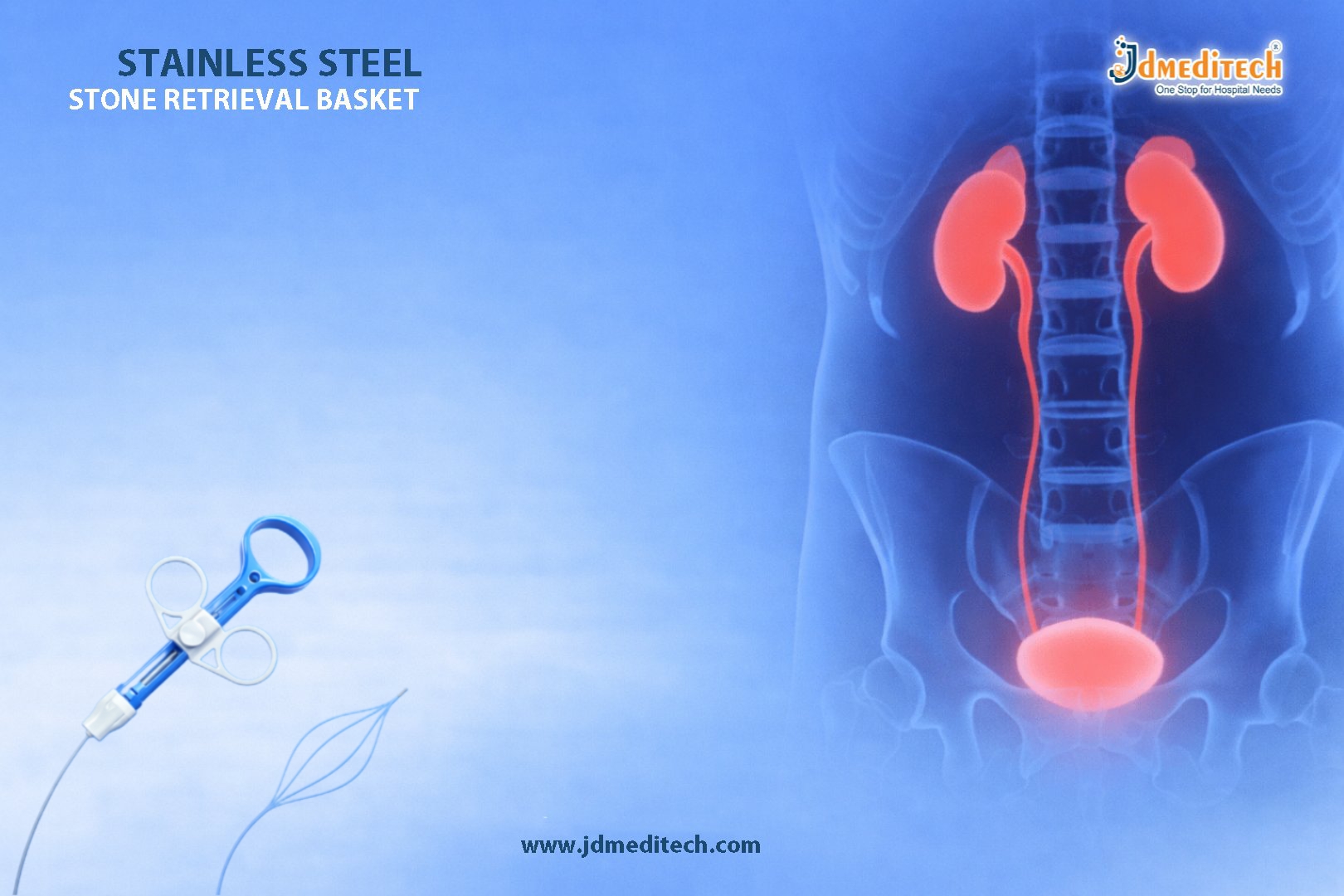 SS Stone Retrieval Basket for Urological Stone Extraction
