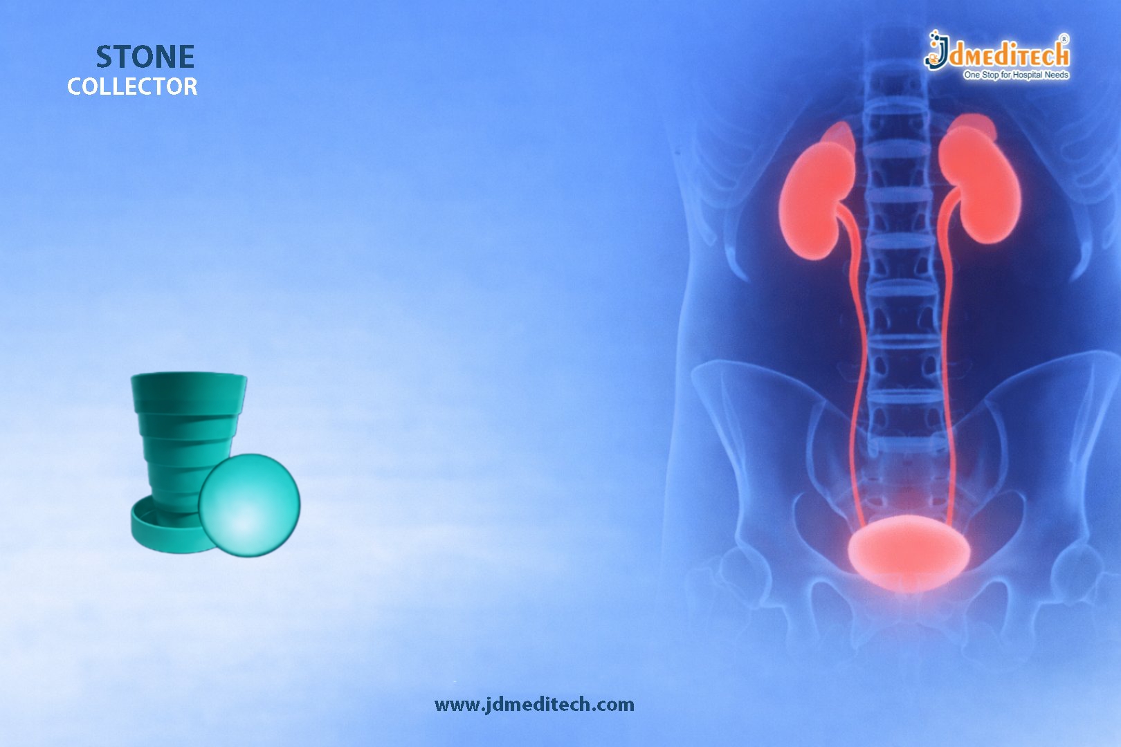 Stone Collector for Safe Stone Retrieval in Urology