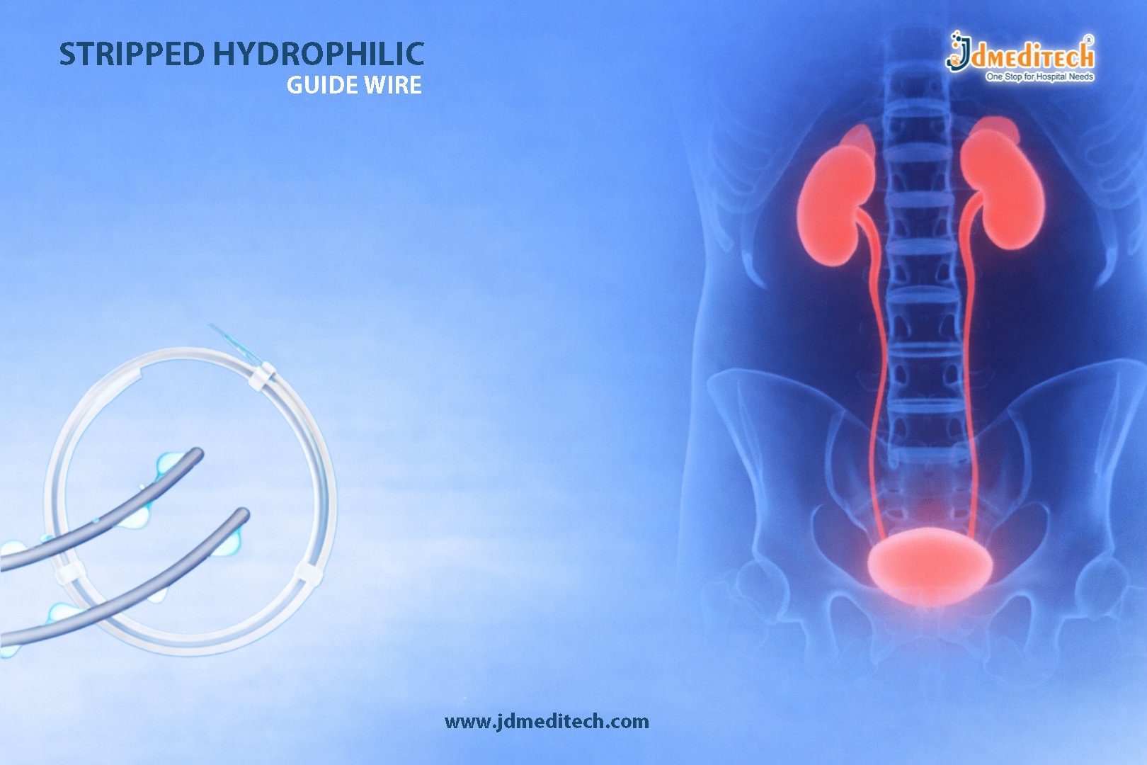 Stripped Hydrophilic Guide Wire – Smooth Urological Access