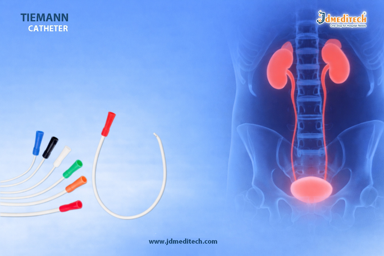 Tiemann Catheter for Urethral Strictures – Precision Urinary Access