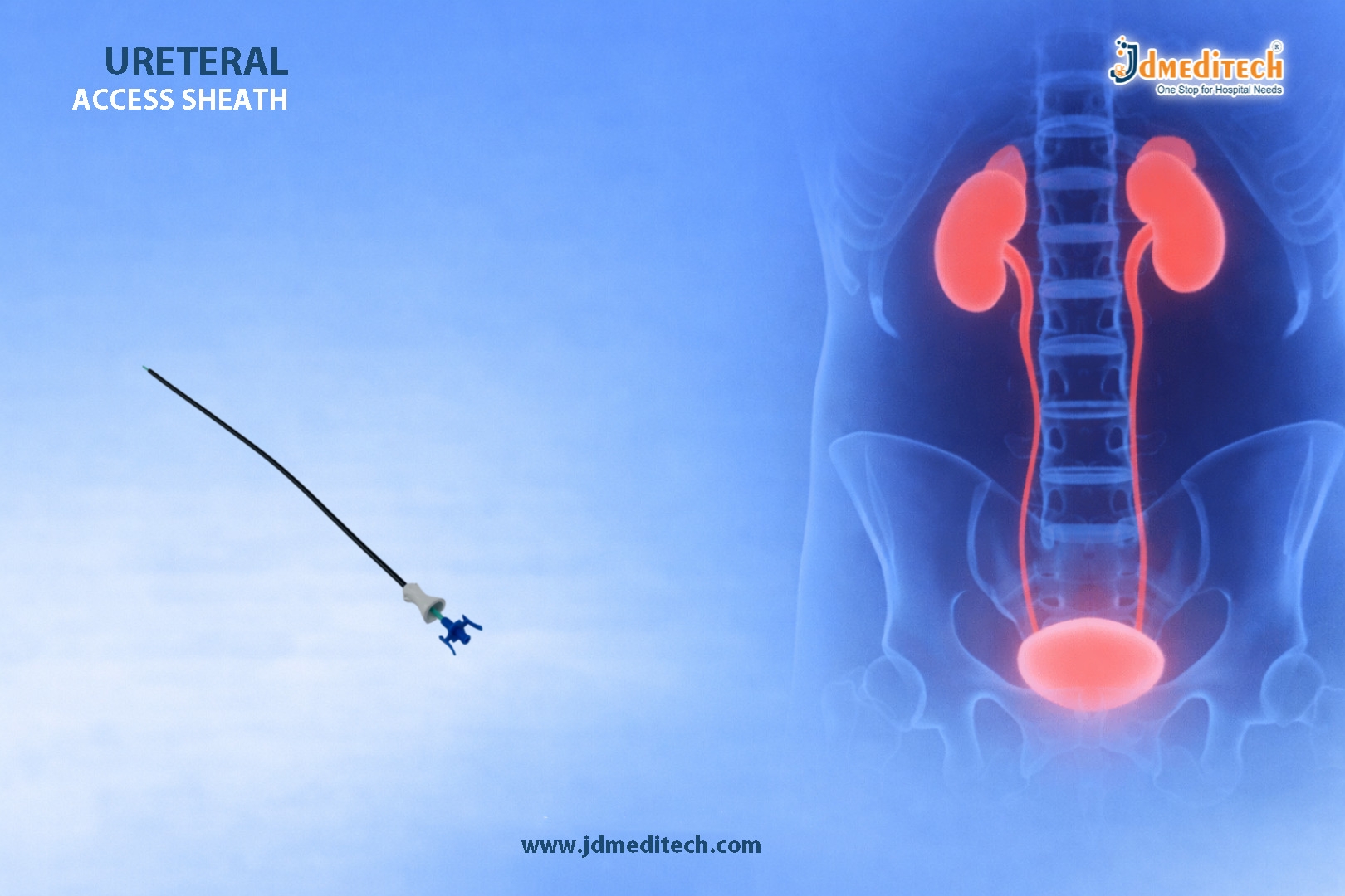 Ureteral Access Sheath for Safe and Smooth Urology Procedures