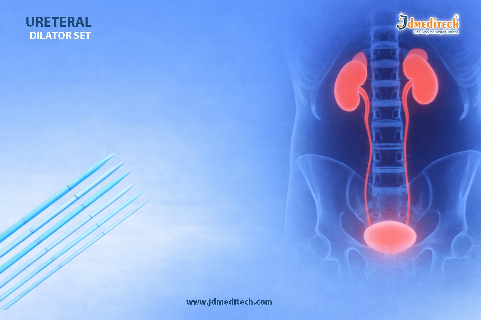 Ureteral Dilator Set – Safe and Precise Ureteral Dilation Tool