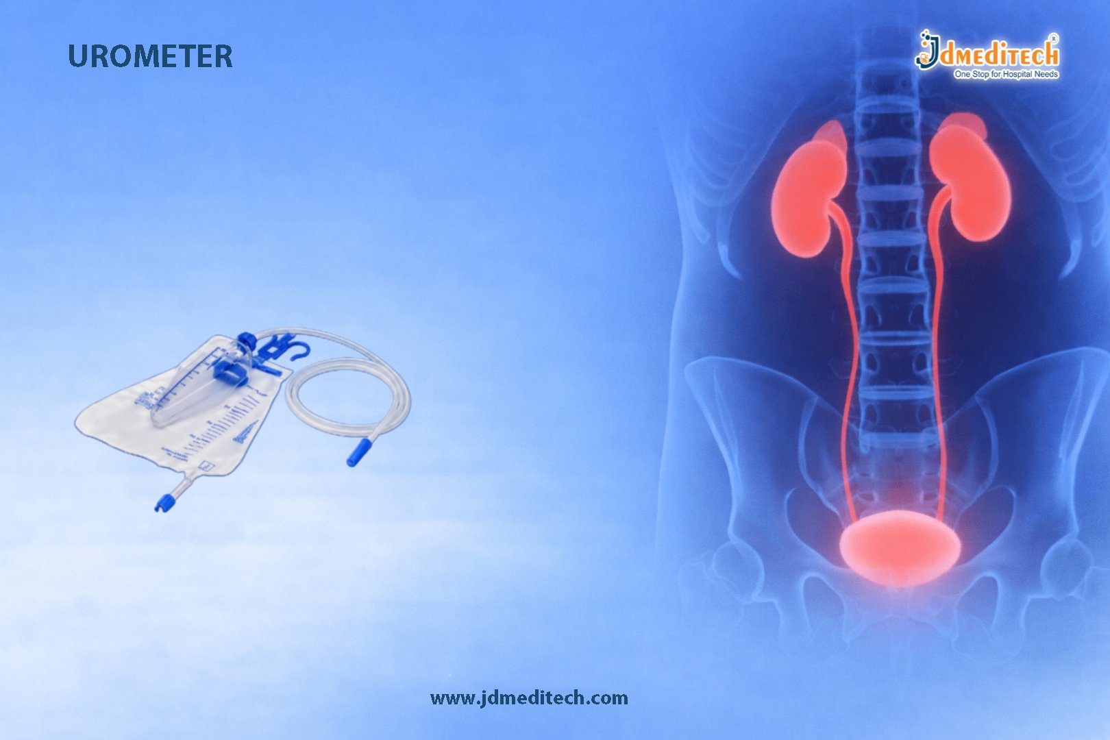 Urometer for Accurate Urine Output Measurement in Critical Care