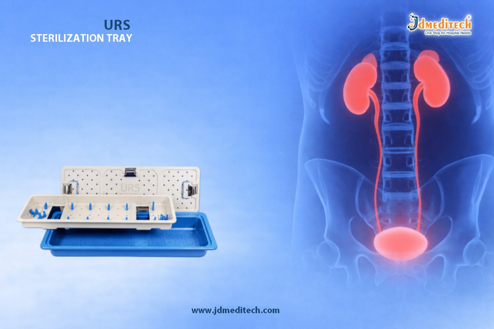 URS Sterilization Tray – Essential for Safe Ureterorenoscopy Procedures