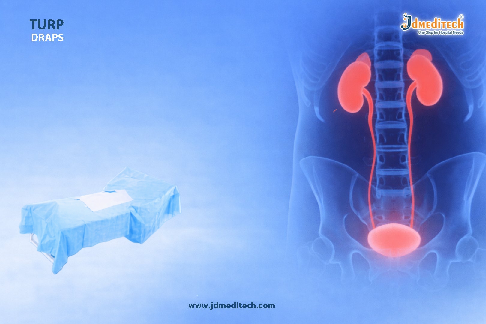 TURP Drape for Prostate Surgery | Sterile Urology Drape