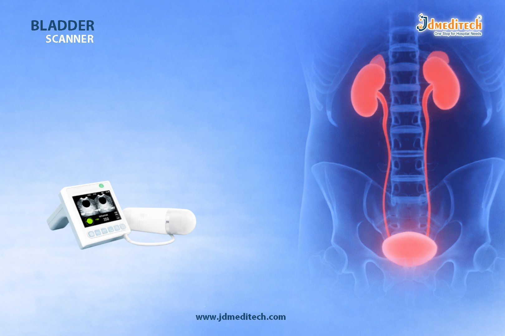 Bladder Scanner – Safe & Efficient Urological Diagnostic Tool