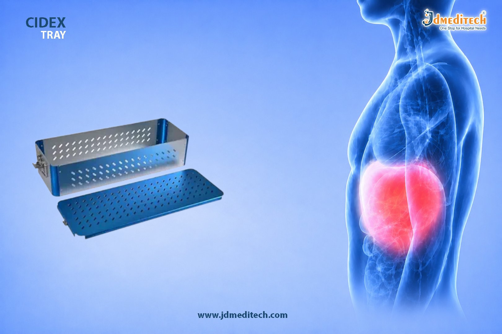 Cidex Tray for Safe Medical Instrument Sterilization