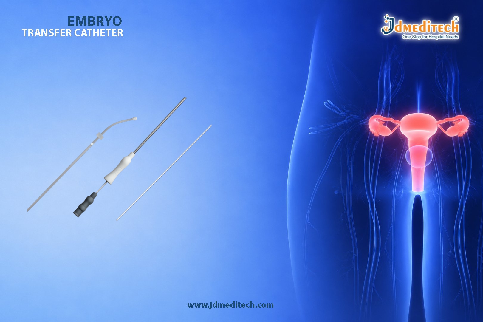 Embryo Transfer Catheter for Accurate and Successful IVF Procedures