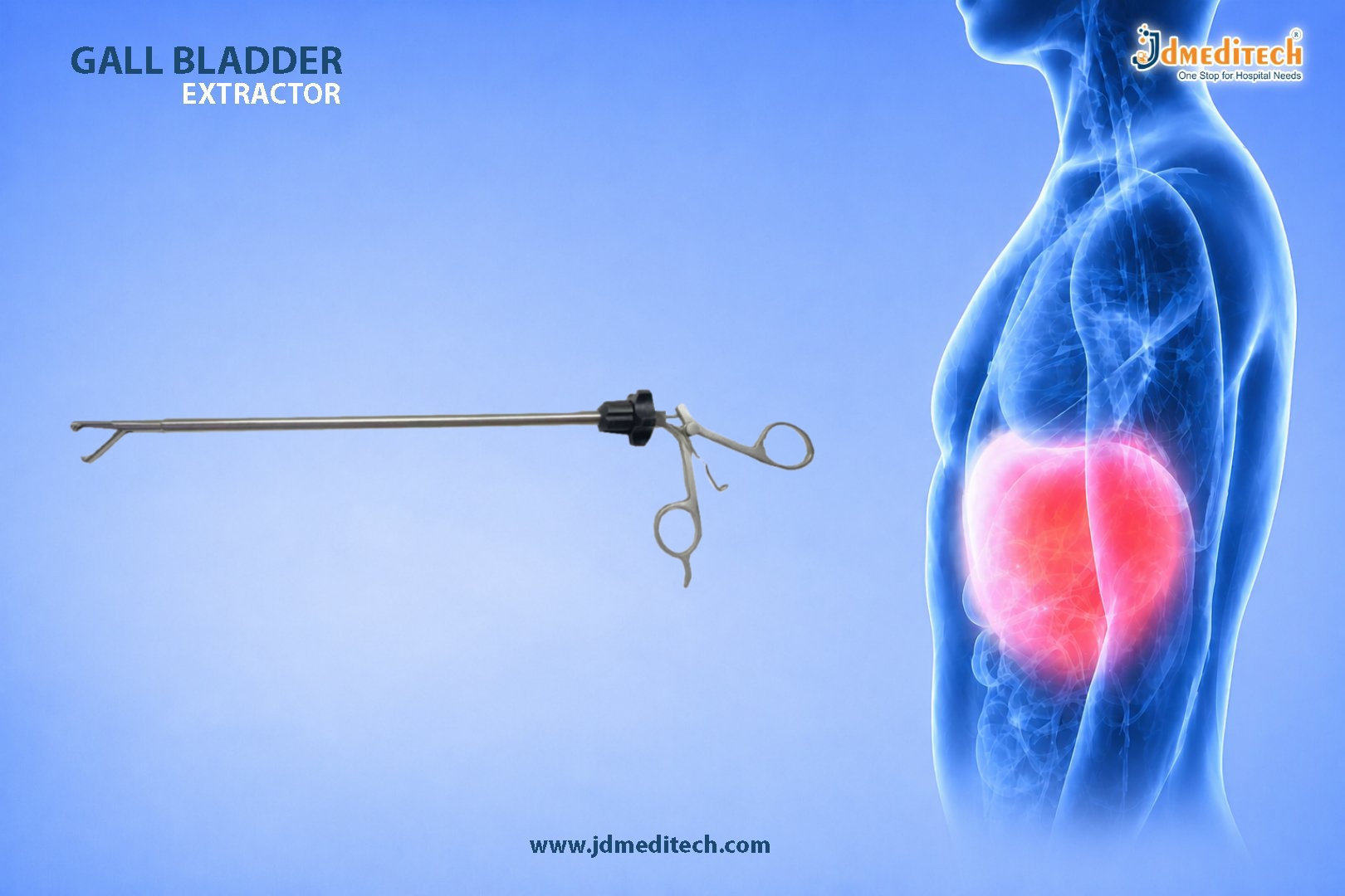 Gall Bladder Extractor for Safe and Controlled Laparoscopic Gallbladder Removal