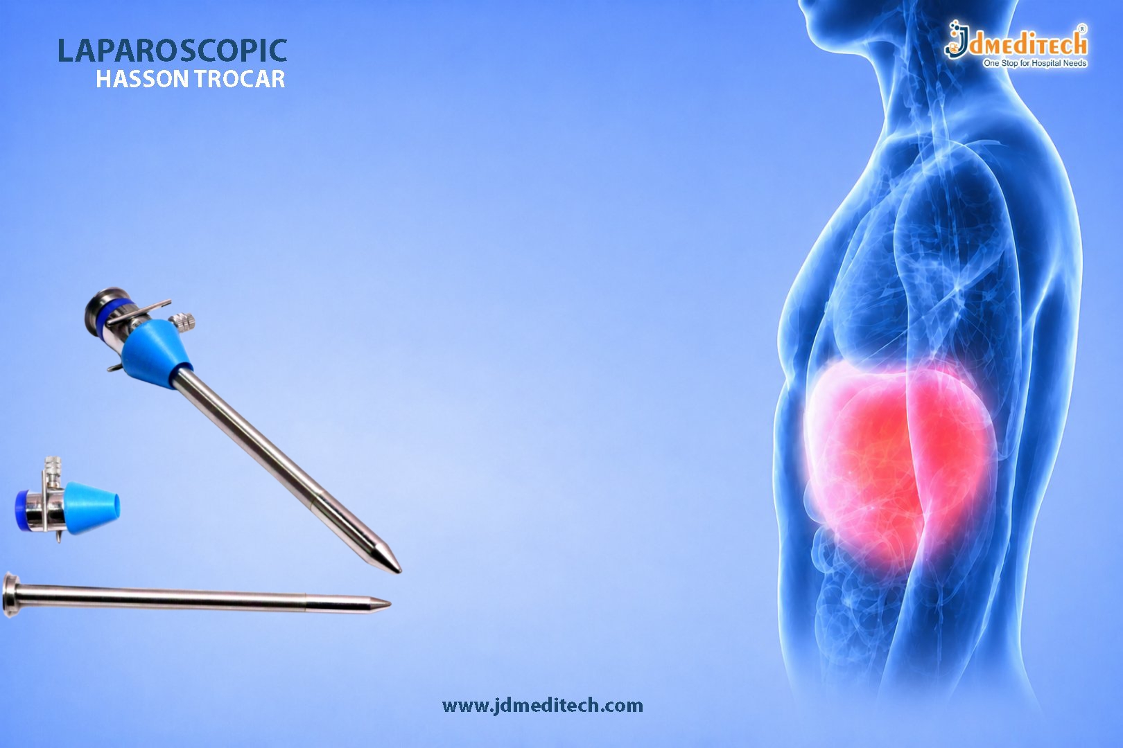 Hasson Trocar for Safe and Secure Laparoscopic Entry