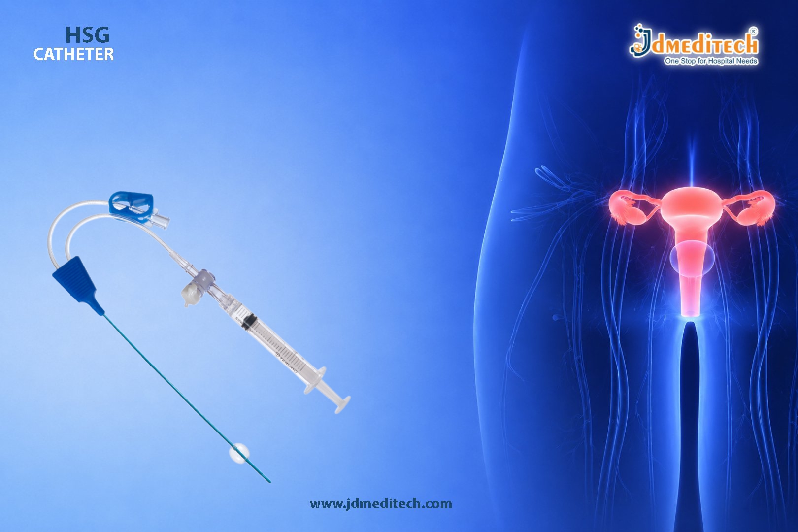 HSG Catheter for Smooth and Accurate HSG Procedures