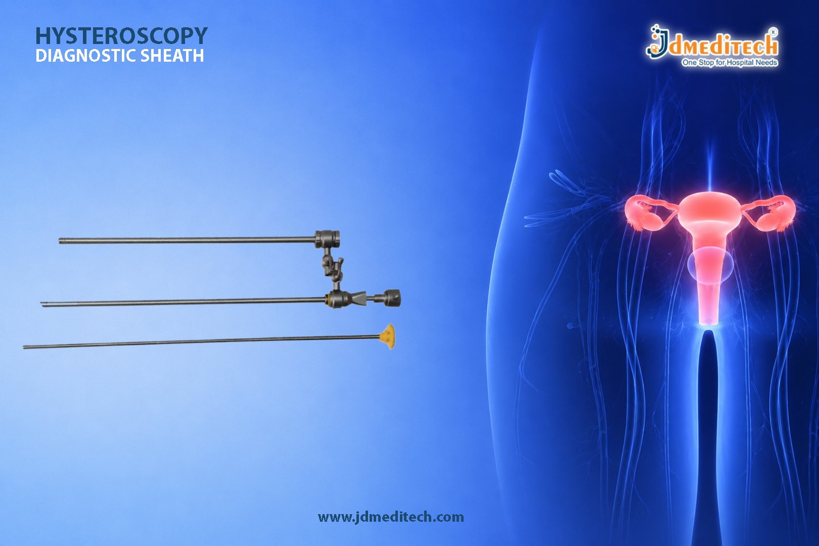 Hysteroscopy Diagnostic Sheath for Safe & Accurate Uterine Examination