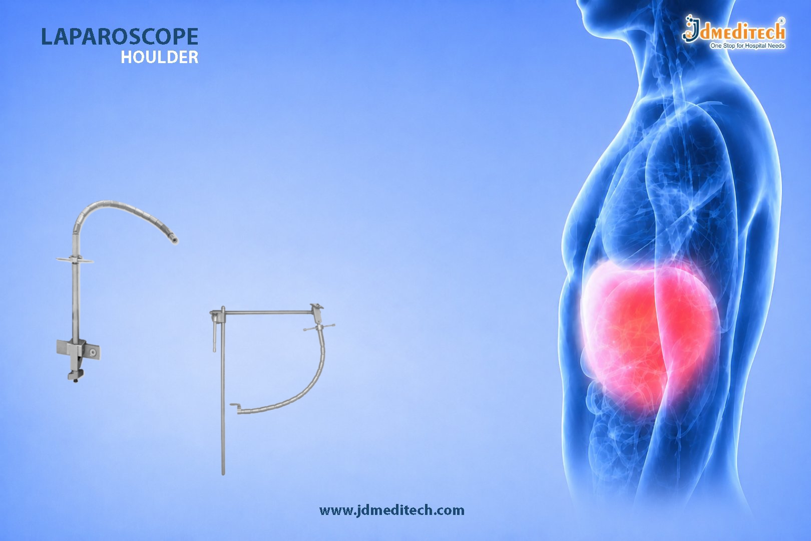 Laparoscope Holder – Stability and Precision for Laparoscopic Procedures