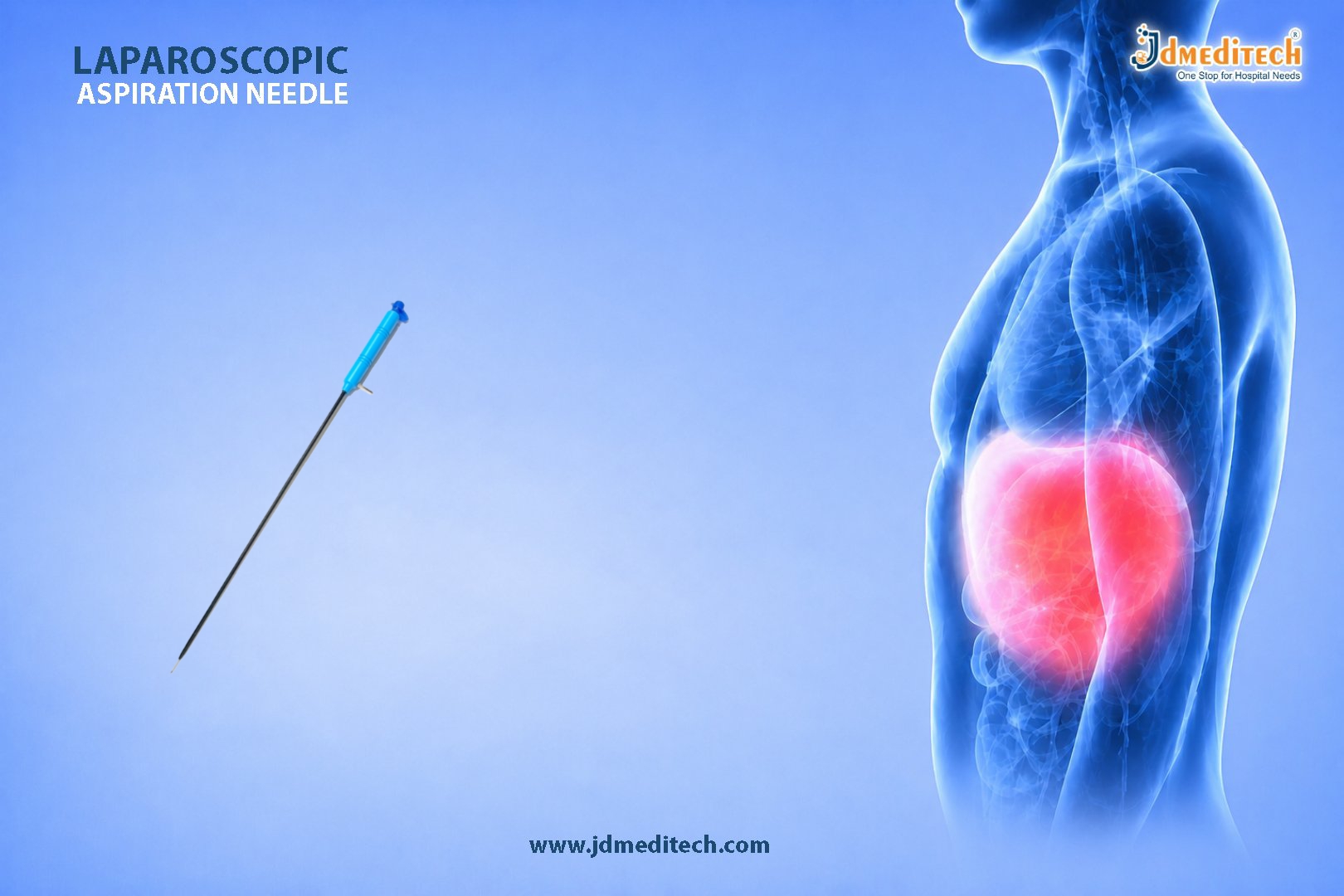 Laparoscopic Aspiration Needle for Safe & Efficient Fluid Management