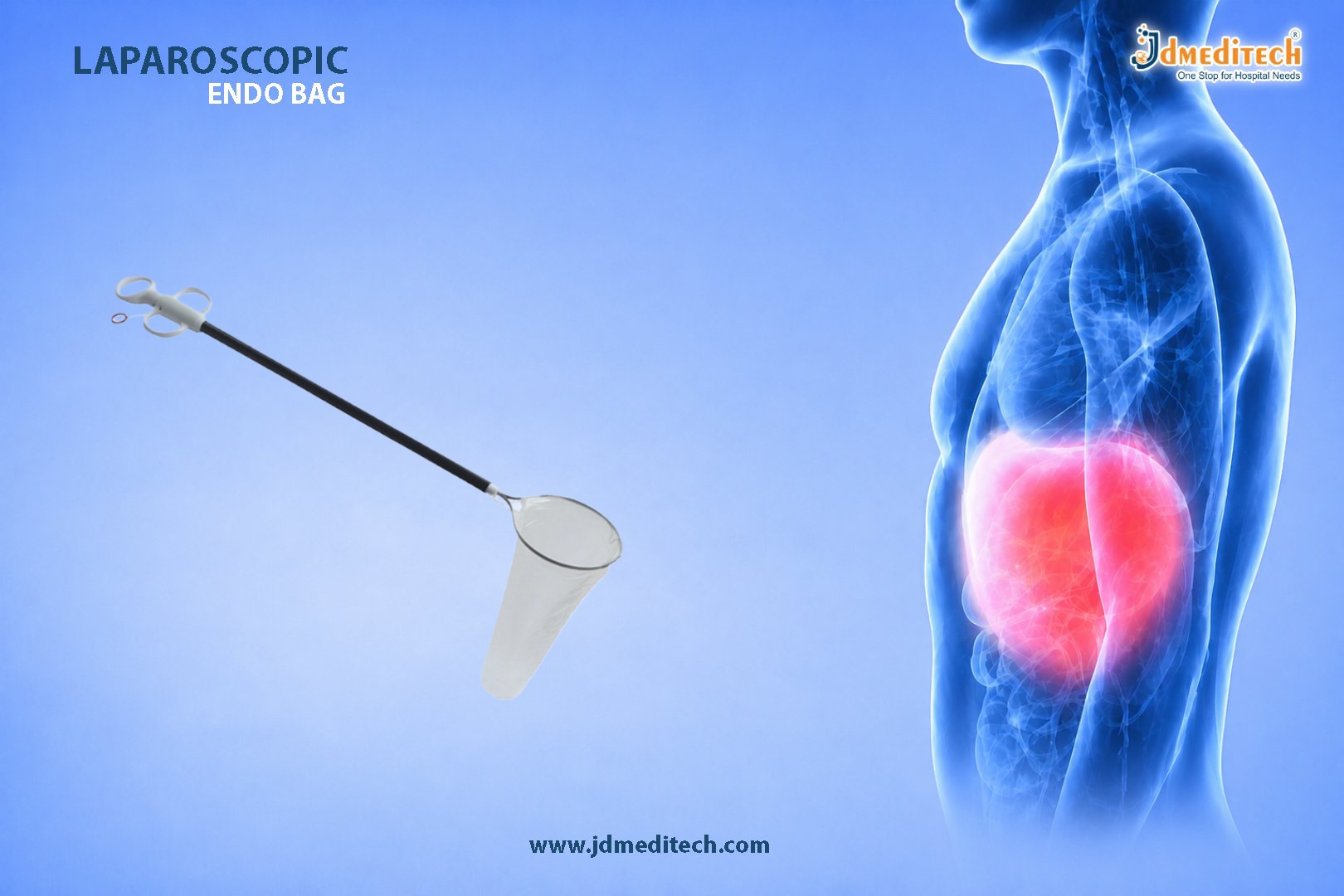 Laparoscopic Endo Bag – Safe Sterile Specimen Retrieval Solution