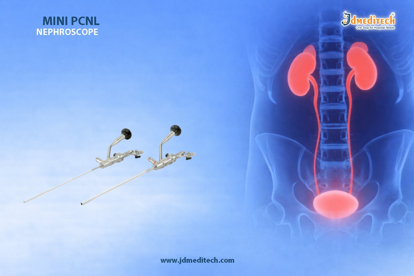 Mini PCNL Nephroscope for Kidney Stone Surgery