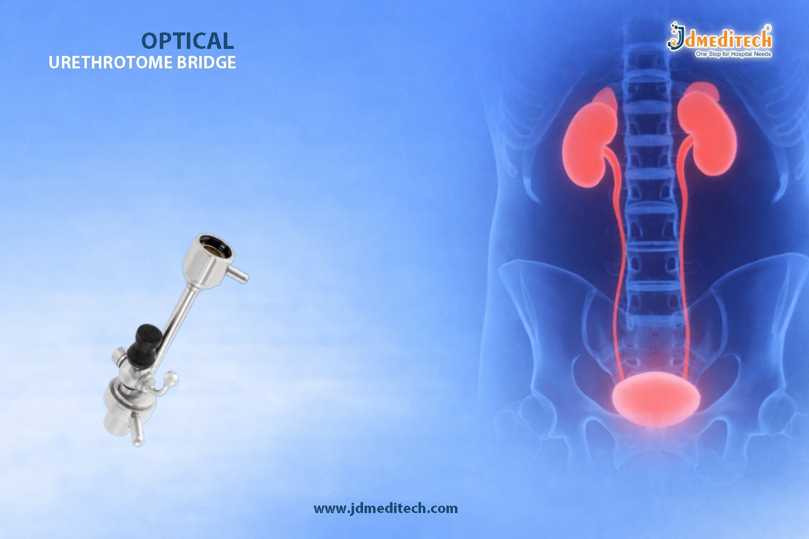 Optical Urethrotome Bridge for Internal Urethrotomy