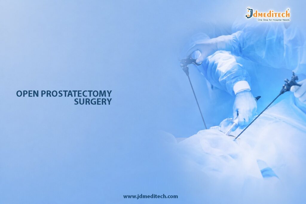 Open Prostatectomy Surgery – Advanced Surgical Treatment for Enlarged Prostate