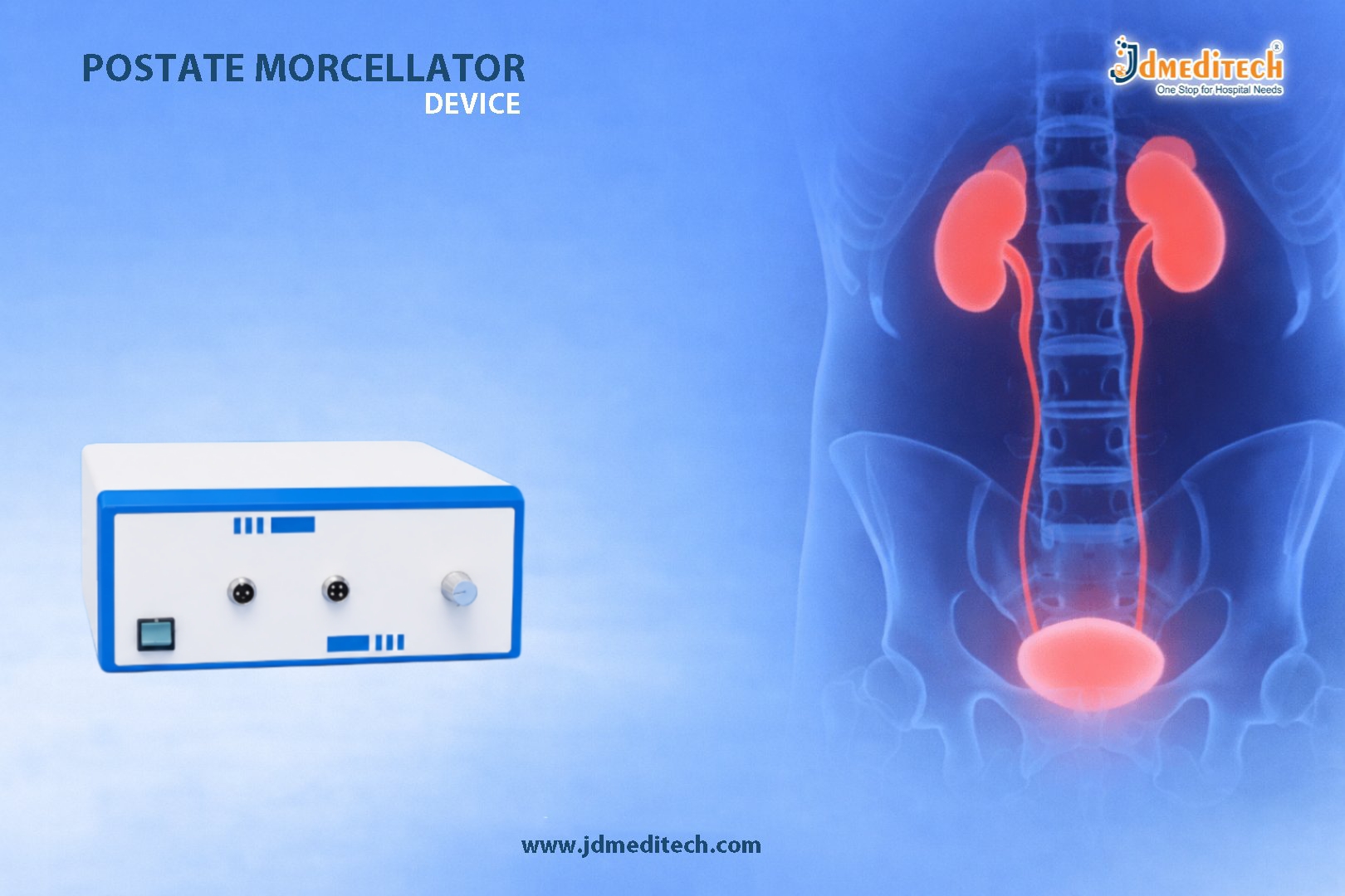 Prostate Morcellator Device for Enucleation Procedures