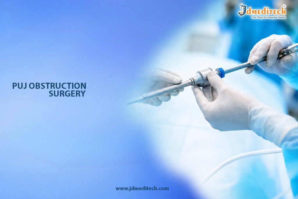 PUJ Obstruction Surgery – Advanced Pyeloplasty Procedure for PUJ Repair