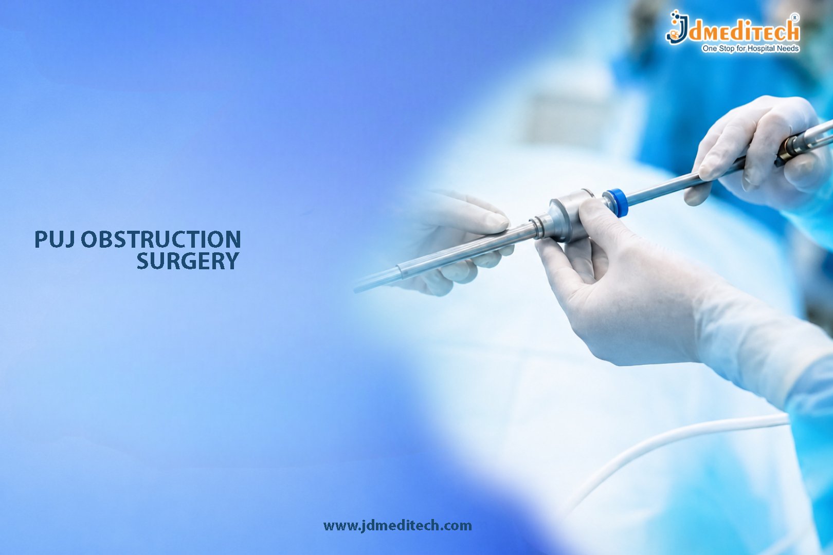 PUJ Obstruction Surgery – Advanced Pyeloplasty Procedure for PUJ Repair