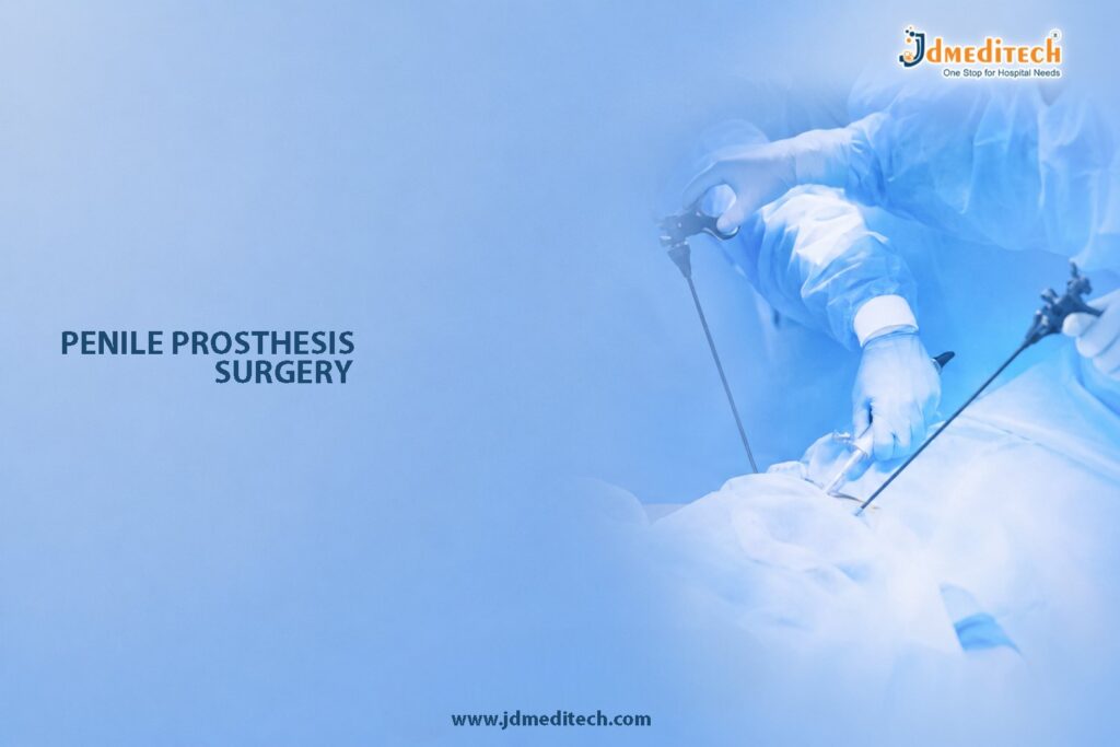 Penile Prosthesis Implantation Surgery for Erectile Dysfunction