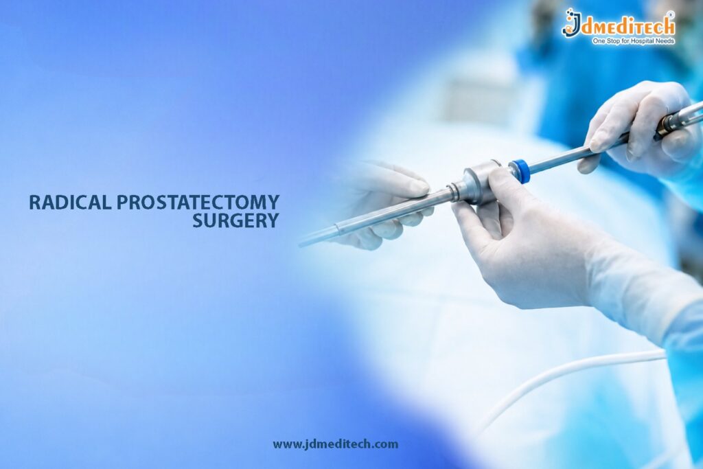 Radical Prostatectomy Surgery – Advanced Surgical Treatment for Prostate Cancer