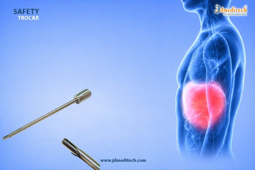 Safety Trocar for Laparoscopic Surgery | Safe Entry Access System