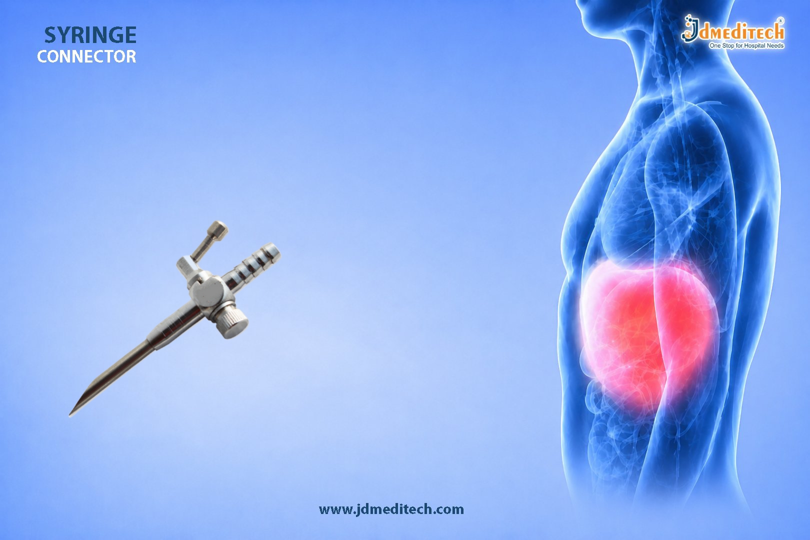 Syringe Connector – Leak-Proof Medical Fluid Transfer Solution