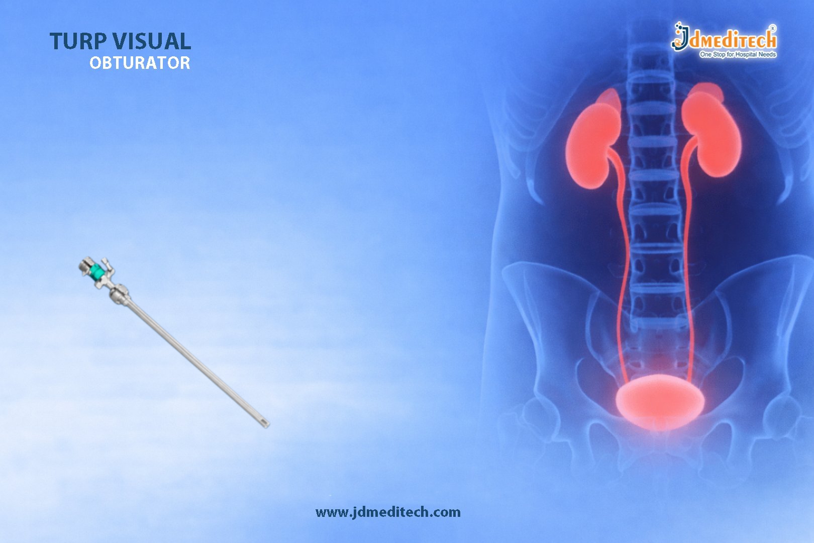 TURP Visual Obturator for Precision TURP Surgery