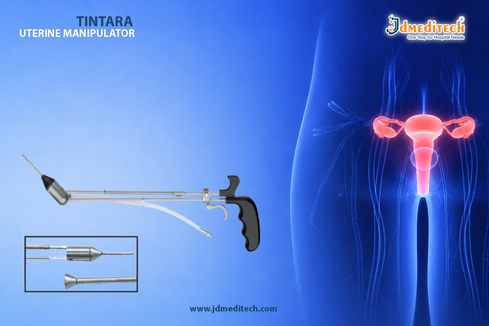 Tintara Uterine Manipulator for Advanced Gynecologic Procedures