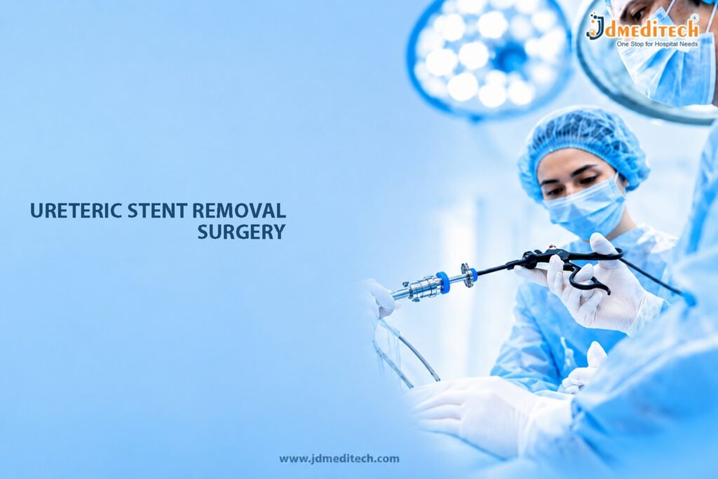 Ureteric Stent Removal Surgery – Safe and Controlled Endoscopic Procedure for Stent Extraction