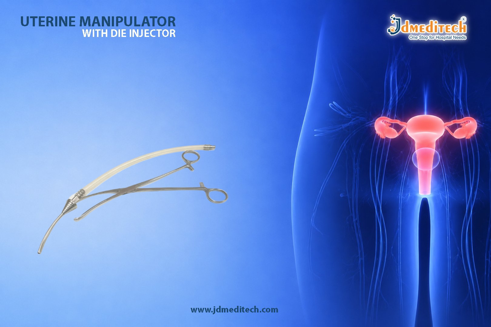 Uterine Manipulator With Die Injector for Accurate Tubal Patency Testing