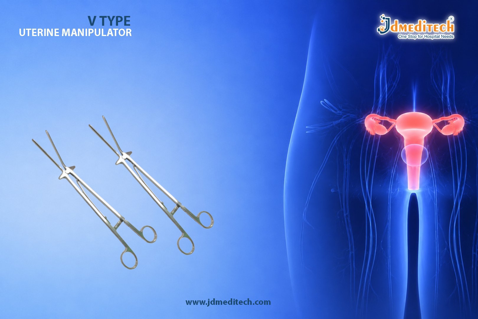 V Type Uterine Manipulator for Advanced Gynecological Surgery