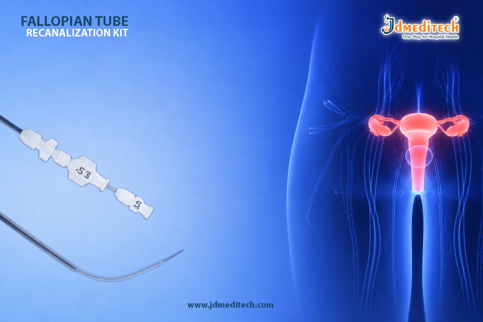 Fallopian Tube Recanalization Kit for Safe and Minimally Invasive Tubal Recanalization