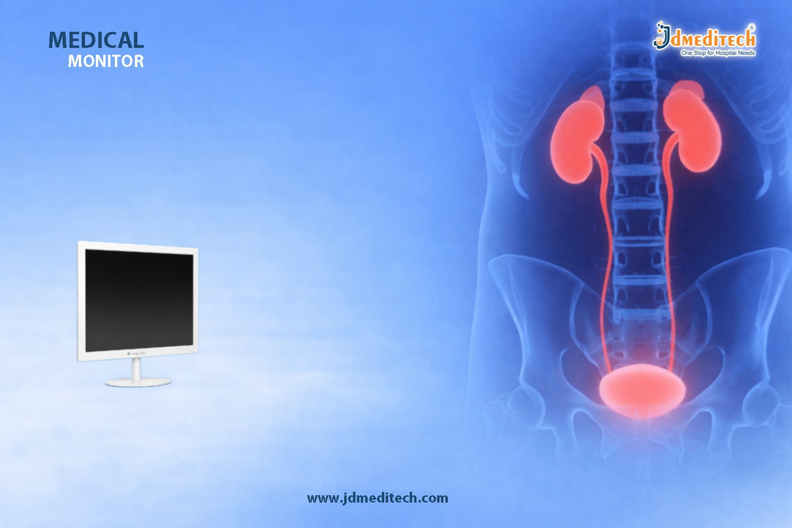 Medical Monitor – High-Resolution Display for Surgical Imaging