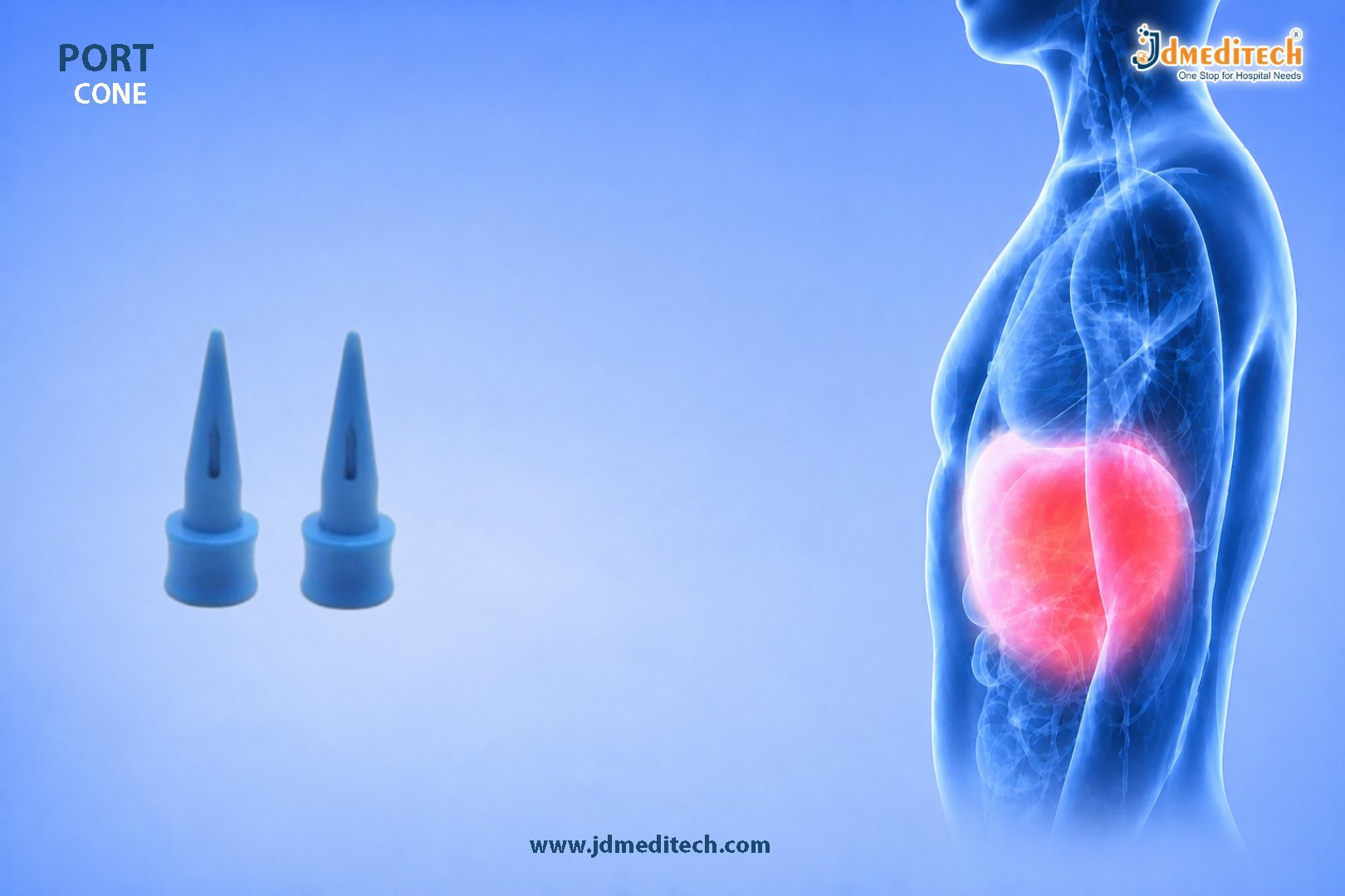 Port Cone for Secure Laparoscopic Port Placement
