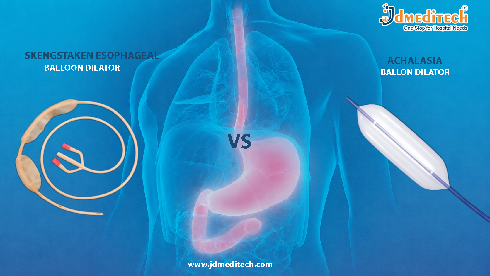 Achalasia vs Sengstaken Balloon Dilator Guide