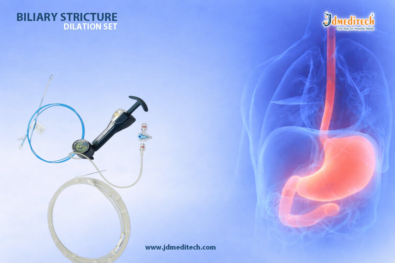 Biliary Stricture Dilation Set for Bile Duct Expansion
