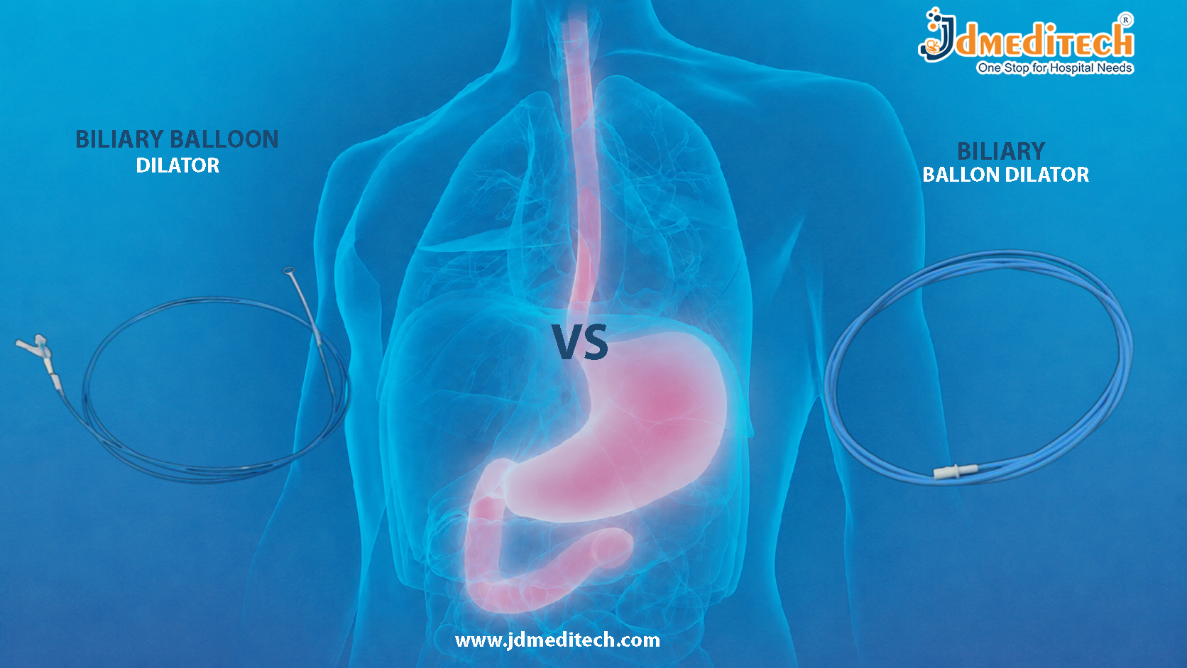 Biliary Dilator vs Balloon Dilator in ERCP