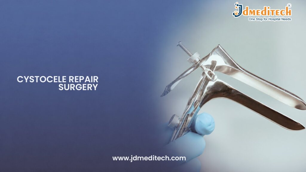 Cystocele Repair Surgery | Advanced Bladder Prolapse Treatment