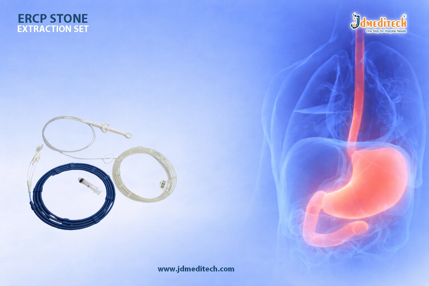 ERCP Stone Extraction Set for CBD Stone Removal