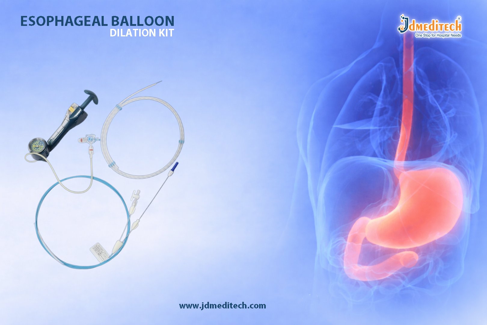 Esophageal Balloon Dilation Kit for Stricture Management