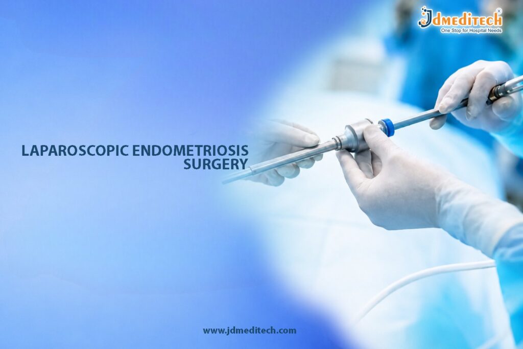 Laparoscopic Endometriosis Surgery – Advanced Treatment for Pain Relief & Fertility Preservation