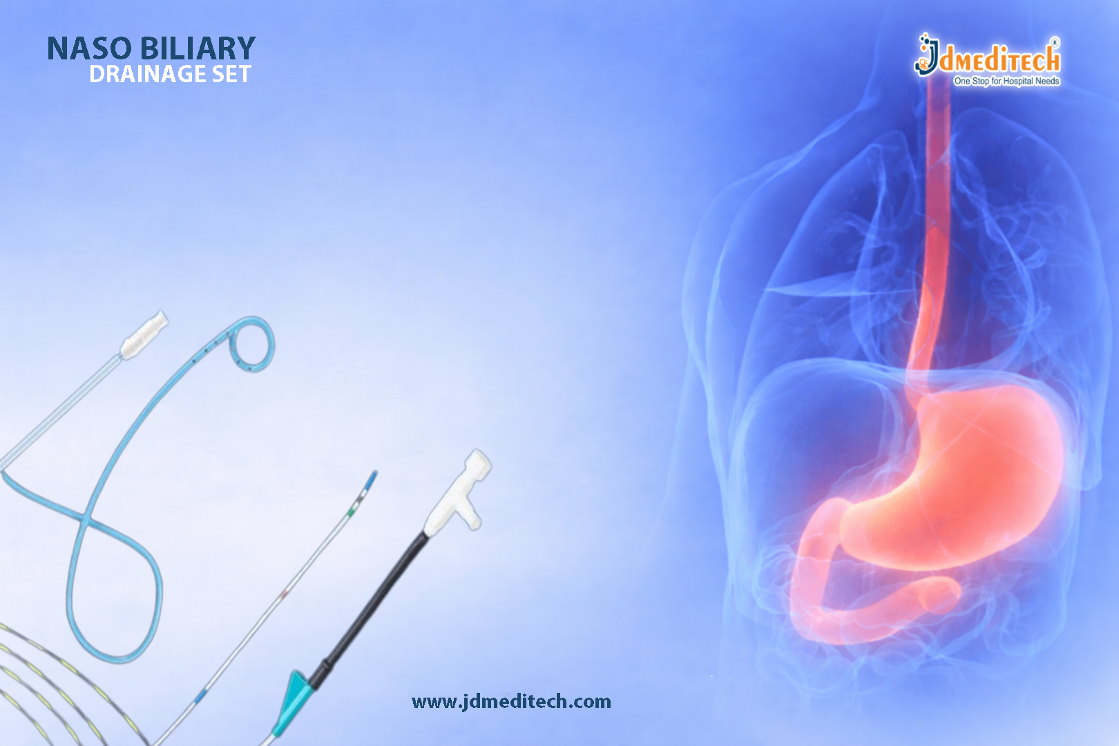 Naso Biliary Drainage Set – Effective Temporary Biliary Decompression Solution