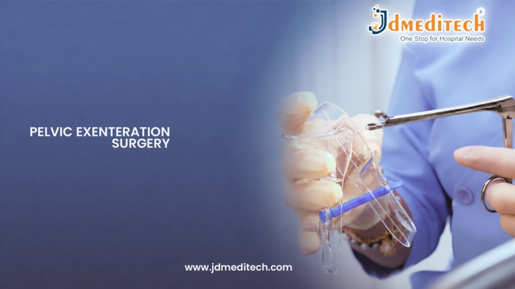 Pelvic Exenteration Surgery for Advanced Pelvic Cancer Treatment