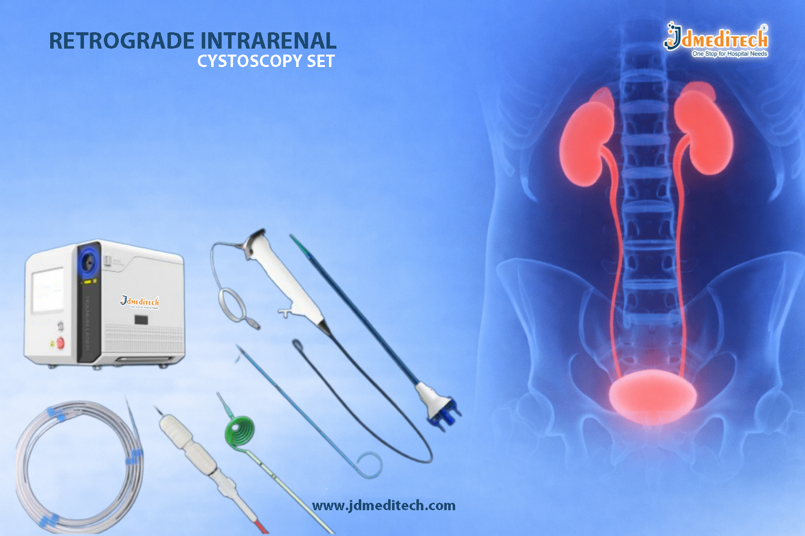 Retrograde Intrarenal Surgery Set for Safe Kidney Stone Removal