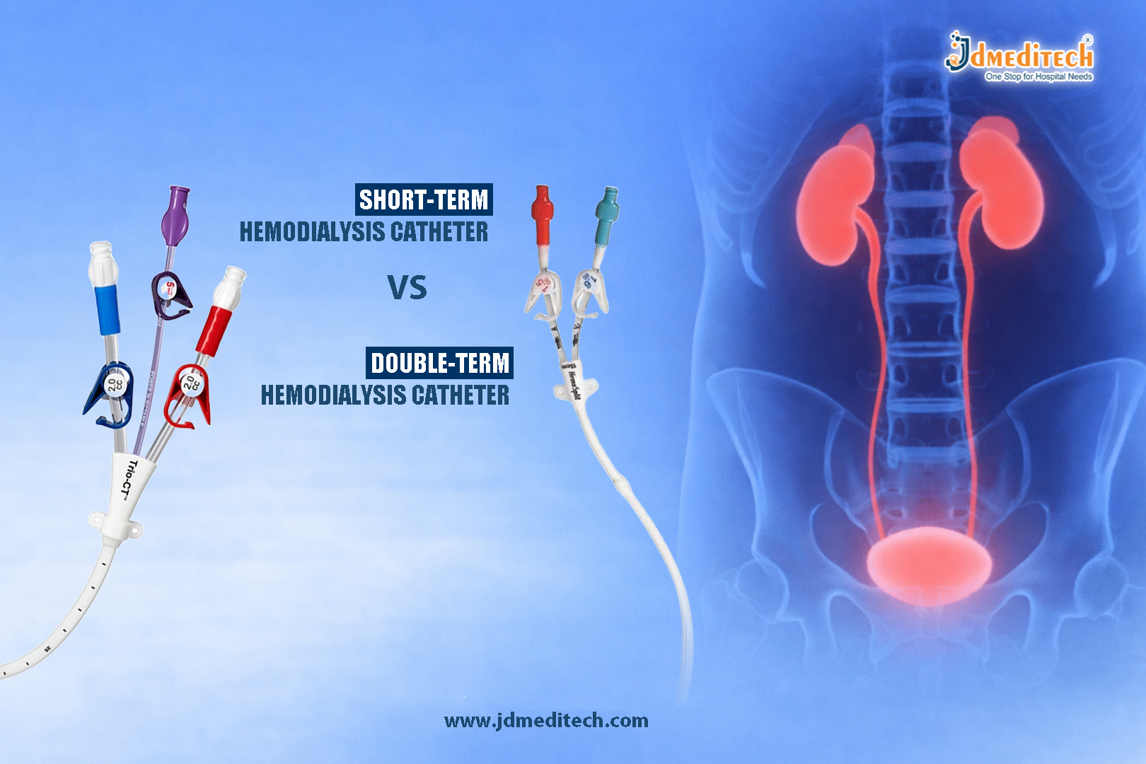 Short-Term vs Long-Term Hemodialysis Catheters: Key Differences